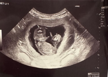 Ultraschallbild von Ōkami-Koa